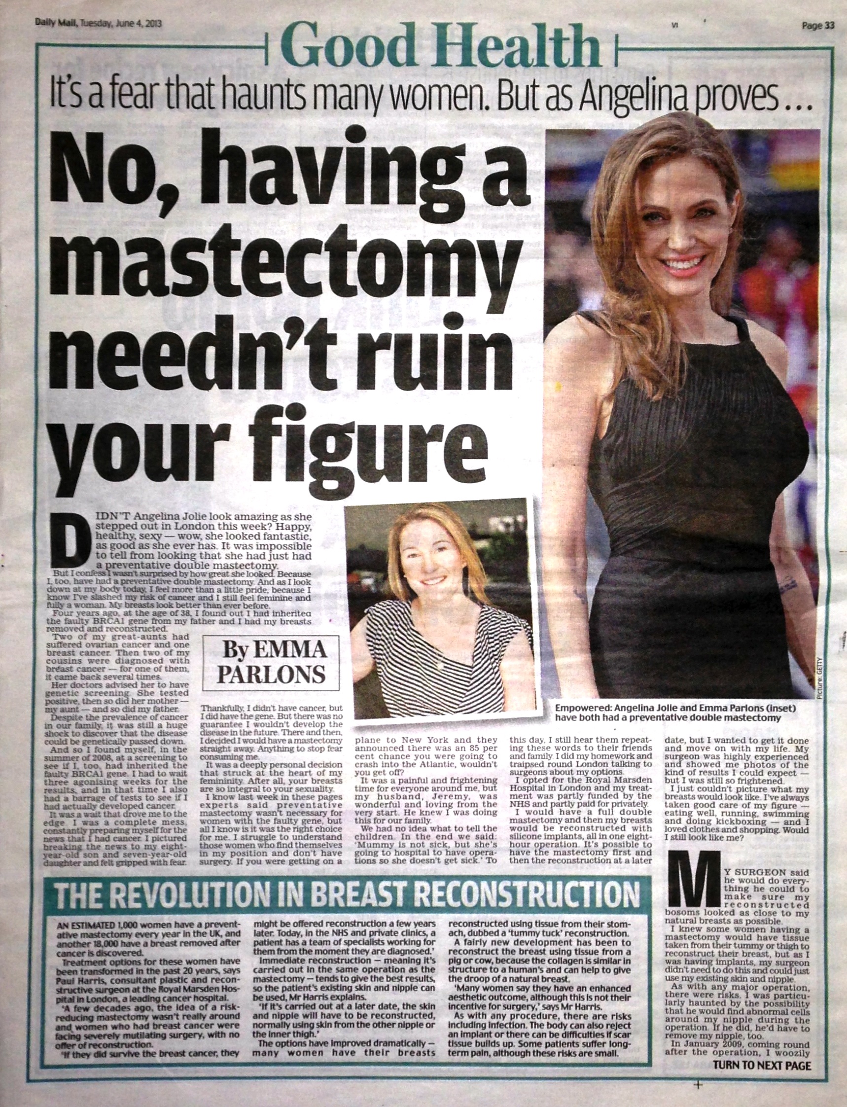 Breast reconstruction uk picture 427